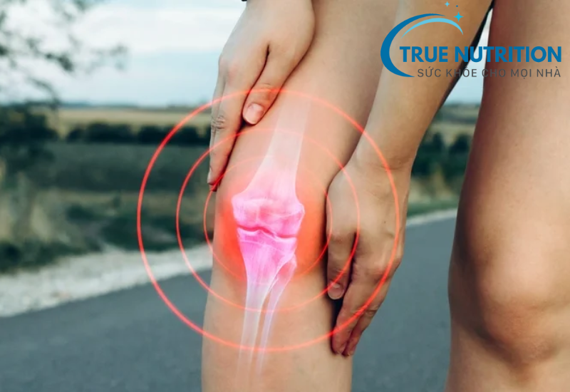 Các Câu Hỏi Thường Gặp Về Xương Khớp: Tư Vấn Hữu Ích Cho Sức Khỏe