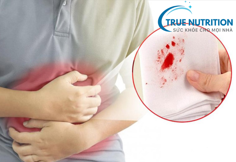 Xuất huyết bao tử có nguy hiểm không? Đừng Chủ Quan