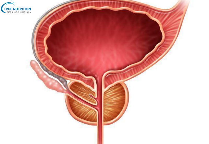 Bệnh Phì Đại Tuyến Tiền Liệt: Nguyên Nhân và Cách Phòng Ngừa Hiệu Quả