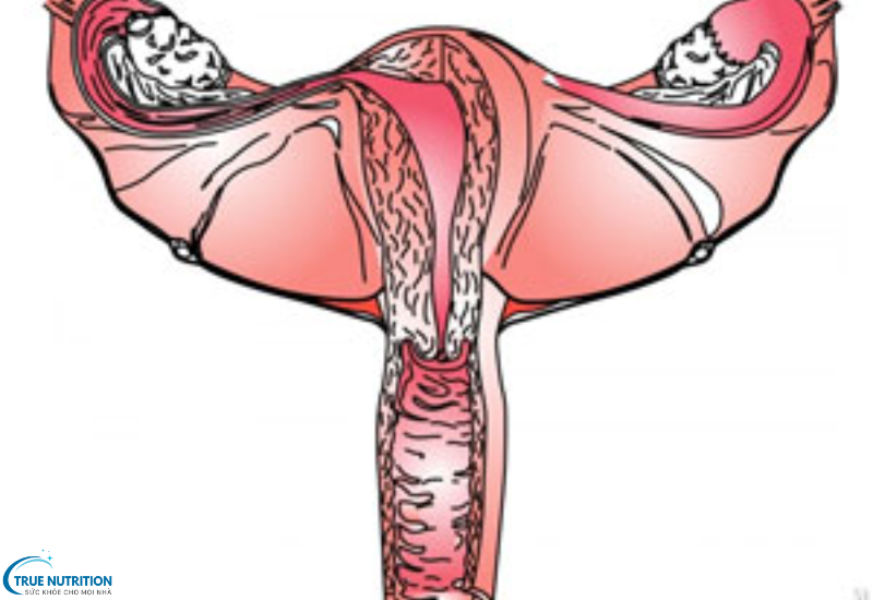 Bệnh Sa Sinh Dục Là Gì? Những Điều Bạn Cần Biết Để Bảo Vệ Vùng Chậu