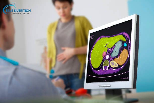 Bệnh Wilson có chữa được không? Chuyên Gia Giải Đáp Chi Tiết