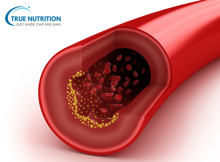 Biến Chứng Mạch Máu Lớn Của Bệnh Tiểu Đường: Nguy Cơ Tiềm Ẩn Và Cách Đối Phó Hiệu Quả