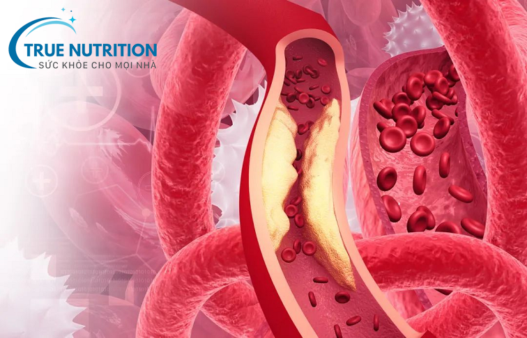 Biến Chứng Mạch Máu Nhỏ Của Bệnh Tiểu Đường: Những Hệ Lụy Nguy Hiểm Và Giải Pháp Phòng Ngừa