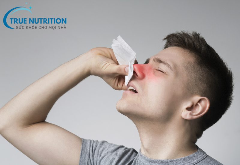 Chảy Máu Cam: Nguyên Nhân, Phân Loại Và Phòng Ngừa