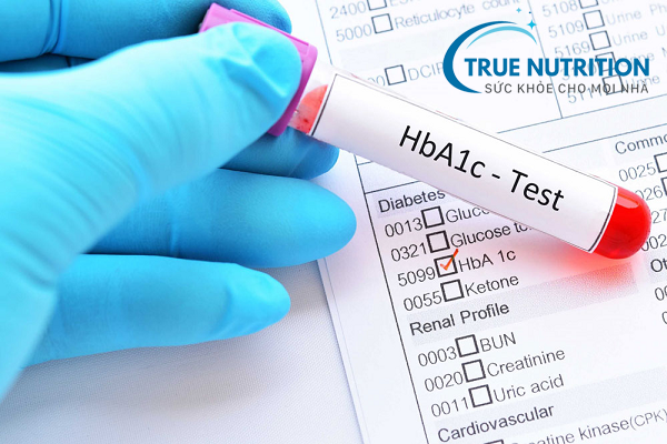 Chỉ số HbA1c tại sao lại quan trọng với người bệnh tiểu đường