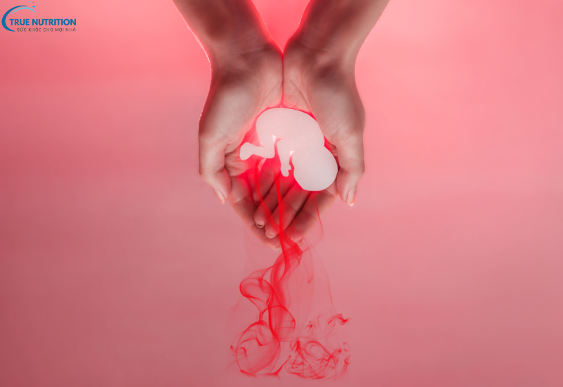 Dấu Hiệu Sảy Thai: Cảnh Báo Sớm Những Triệu Chứng Cần Chú Ý