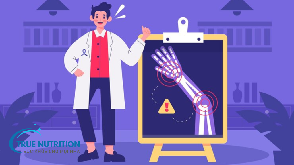 Sốc: Nguyên Nhân Xương Gãy Di Lệch Sau Khi Đã Lành