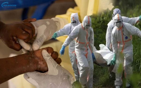 Dịch Bệnh Ở Congo Bùng Phát: Đằng Sau Sự Bí ẩn Và Những Cảnh Báo