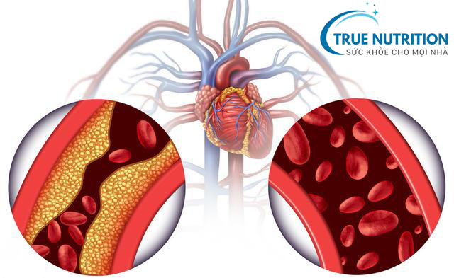 Điều Trị Biến Chứng Tiểu Đường: Hướng Dẫn Toàn Diện và Phương Pháp Hiệu Quả