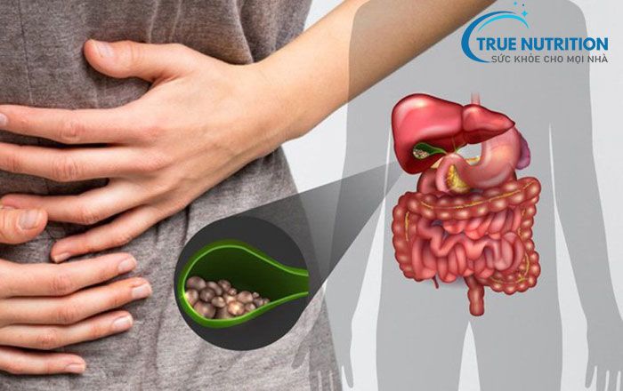 Sỏi Bùn Gan Có Thực Sự Nguy Hiểm?