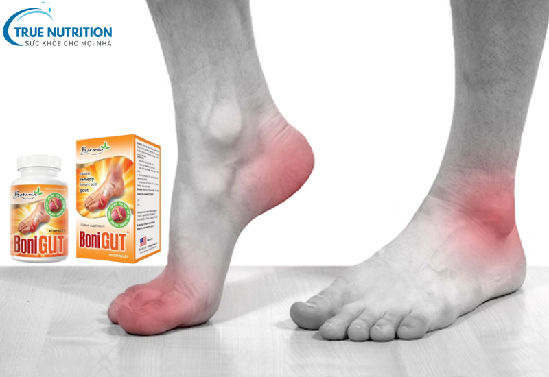 Giá Bán Bonigut: Bí Quyết Chọn Sản Phẩm Chất Lượng