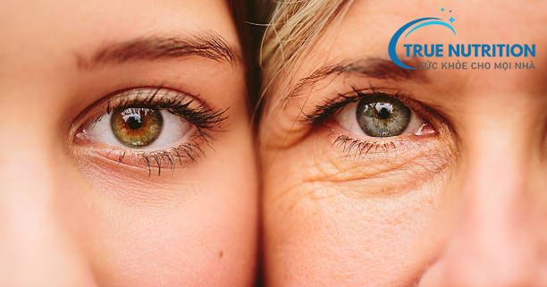 4 Dấu Hiệu Trên Khuôn Mặt Cảnh Báo Thiếu Máu Não – Bạn Có Đang Bỏ Qua?