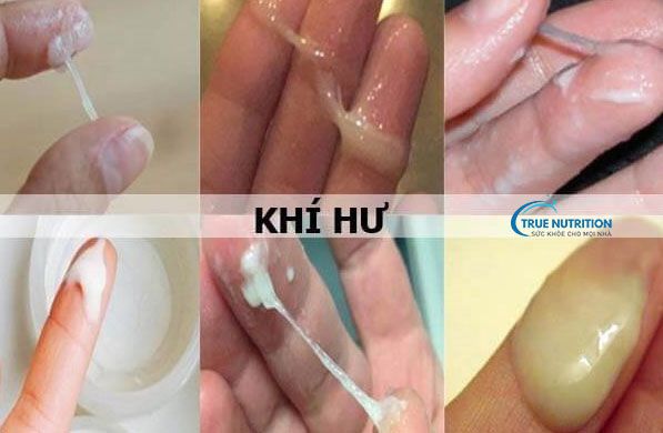 Khí Hư Bất Thường Trong Thai Kỳ: Màu Sắc, Mùi, Đặc Điểm