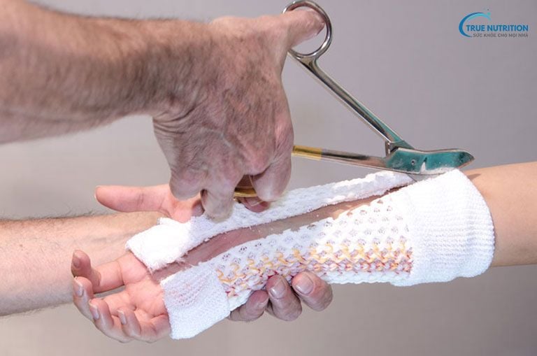 Hướng Dẫn Cách Tháo Bột Thủy Tinh Tại Nhà An Toàn