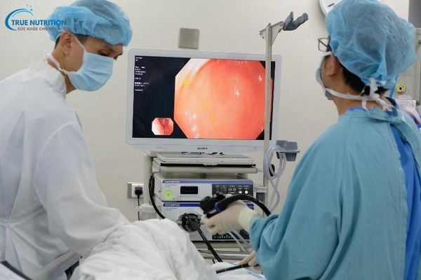 Khi Nào Cần Nội Soi Dạ Dày: Lưu Ý Trước & Sau Khi Nội Soi