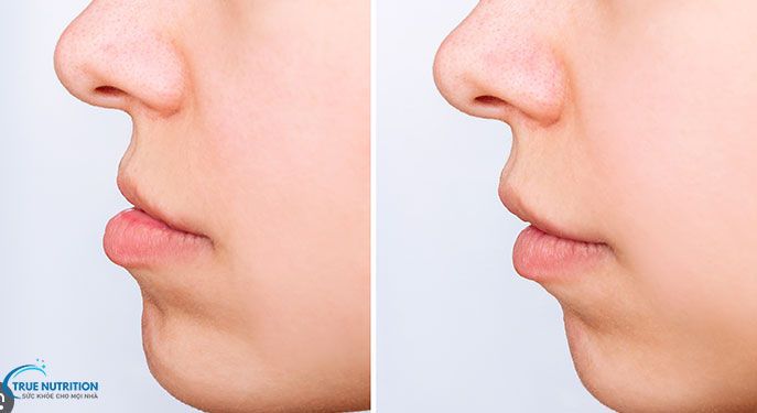 Khớp Cắn Chuẩn Cách Xác Định - Nhìn Nghiêng Khớp Cắn Chuẩn