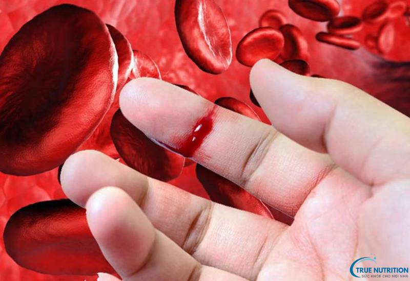 Nguyên Nhân Gây Bệnh Hemophilia: Di Truyền và Các Yếu Tố Cần Biết