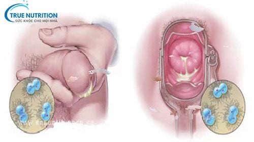 Nhận Diện Hình Ảnh Bệnh Lậu Giai Đoạn Đầu. Khác Biệt Giữa Nam & Nữ