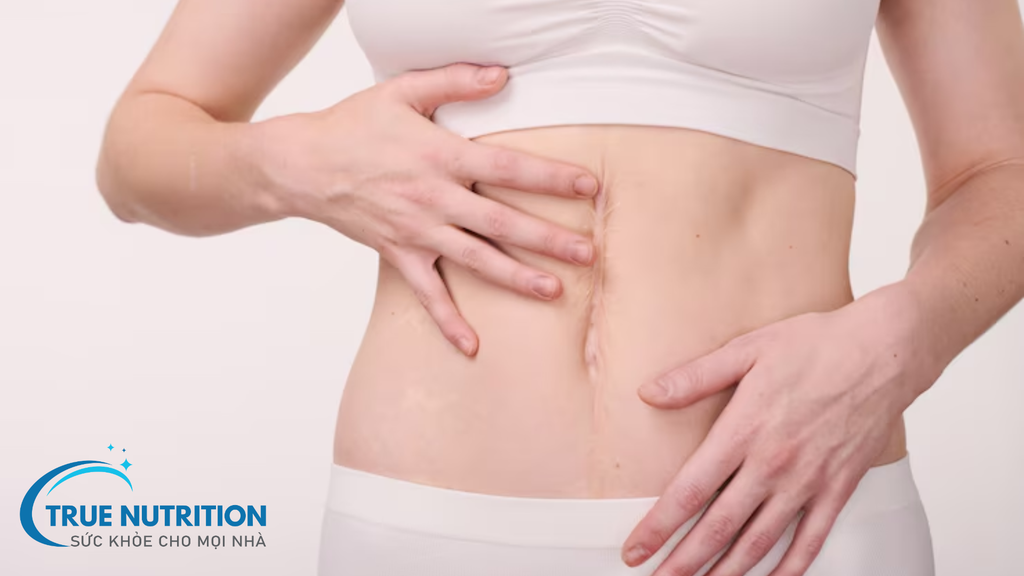 Xóa Sẹo: Những Lời Hứa Không Thể Tin – Khoa Học Nói Gì?