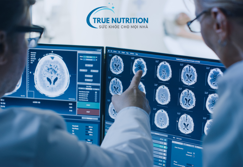 Tầm soát đột quỵ - vấn đề quan trọng khi tìm hiểu căn bệnh quái ác này