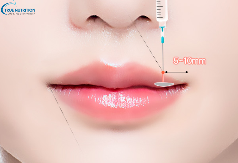 Tạo Hình Môi Có Đau Không? Những Điều Cần Biết Trước Khi Thẩm Mỹ