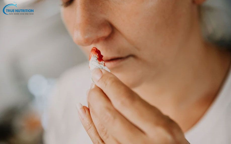 Thang điểm IMPROVE: Yếu Tố Nguy Cơ, Ý Nghĩa, Ứng Dụng