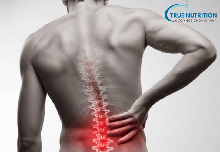 Bệnh thoát vị đĩa đệm, làm sao để tránh mắc phải ?