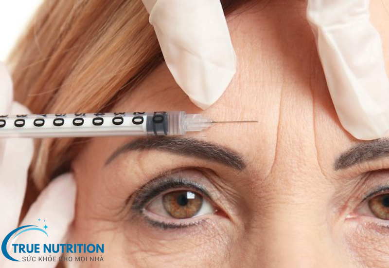 Tiêm Botox: Bí mật của làn da trẻ trung và những điều cần biết