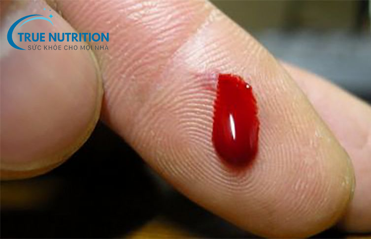 Tiểu Đường Có Bị Máu Khó Đông Không? Khám Phá Mối Liên Hệ Và Cách Quản Lý Hiệu Quả