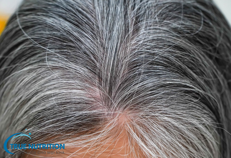 Tóc Bạc Sớm: Nguyên Nhân và Cách Khắc Phục Hiệu Quả