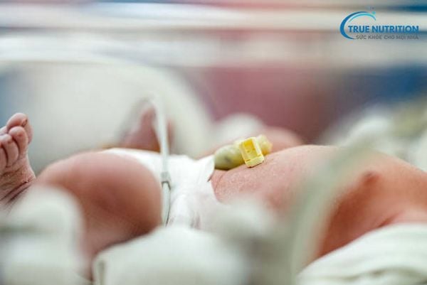 Tồn tại nang ống niệu rốn ở trẻ sơ sinh là gì? Bao giờ cần mổ?