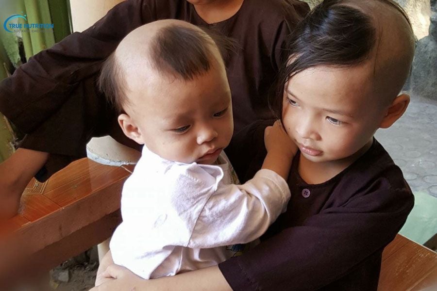 Trẻ Sinh Ra Có Tóc Ba Chỏm: Quan Niệm Tâm Linh & Lý Giải Khoa Học