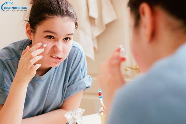 Trị Thâm Mụn Cấp Tốc Sau 1 Đêm: Đơn Giản Và Hiệu Quả