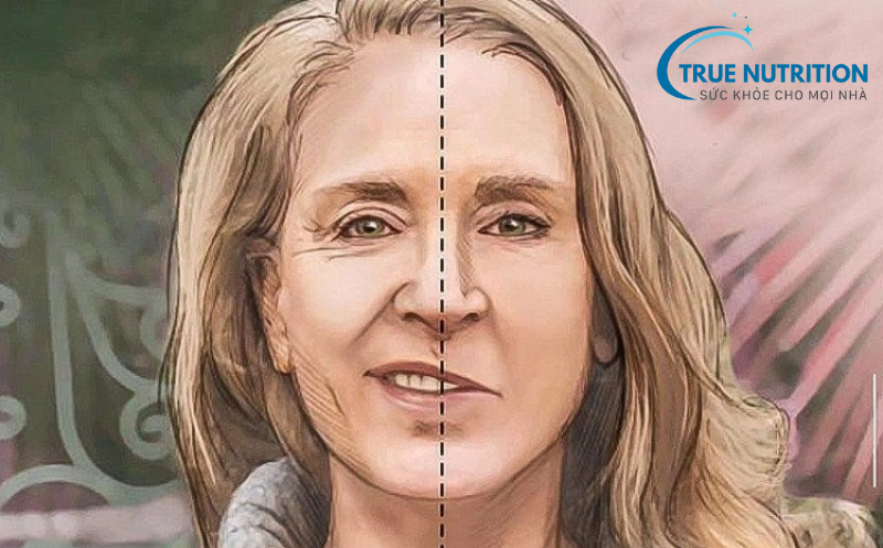 Vấn đề về thần kinh trong bệnh đột quỵ - những điều thú vị cho bạn