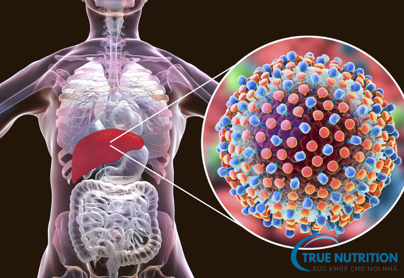 Viêm gan virus – Nguyên nhân, dấu hiệu và cách phòng ngừa hiệu quả