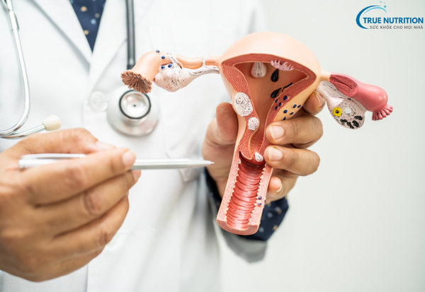 Bệnh Viêm Lộ Tuyến Cổ Tử Cung: Cảnh Báo Nguy Cơ Và Hướng Điều Trị Hiệu Quả