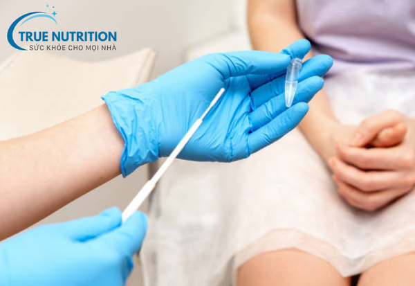 Bệnh Chlamydia: Những Điều Cần Biết Để Phòng Tránh và Điều Trị Hiệu Quả