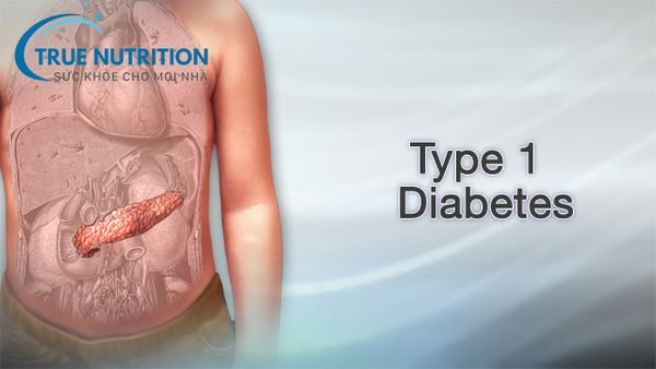 Những Điều Cần Biết Về Tiểu Đường Type 1