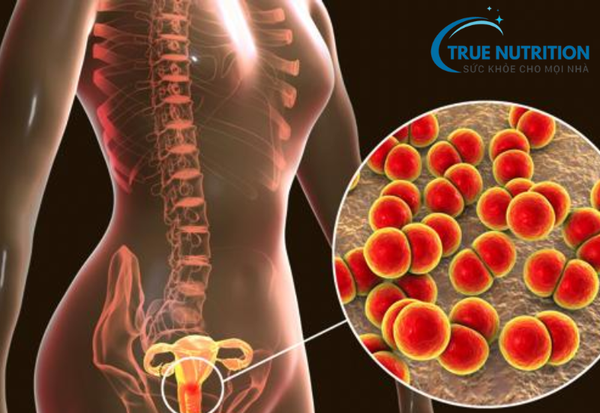 Lậu: Nguyên Nhân, Triệu Chứng, Điều Trị và Cách Phòng Tránh