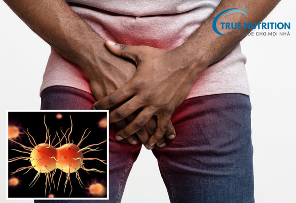 Lậu: Nguyên Nhân, Triệu Chứng, Điều Trị và Cách Phòng Tránh