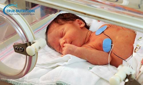 Nhận Diện Hình Ảnh Trẻ Bị Suy Giáp Bẩm Sinh