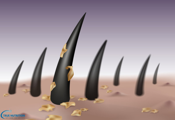 Cách Trị Bệnh Gàu: Bí Quyết Lấy Lại Sự Tự Tin Với Mái Tóc Sạch Gàu