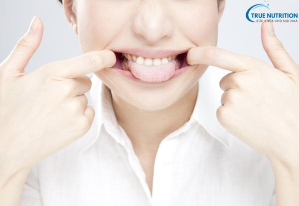 Bệnh Lưỡi Bị Nổi Hột Đỏ Đau Rát: Nguyên Nhân, Dấu Hiệu Và Cách Xử Lý