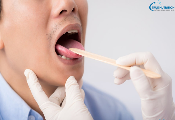 Bệnh Lưỡi Bị Nổi Hột Đỏ Đau Rát: Nguyên Nhân, Dấu Hiệu Và Cách Xử Lý