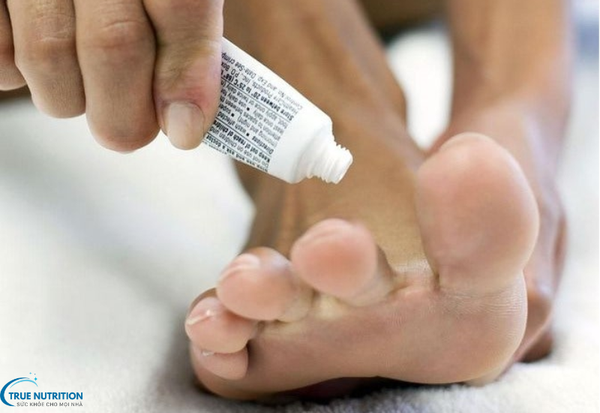 Cách Chữa Bệnh Lang Ben: Giải Pháp Đúng Đắn Cho Làn Da Khỏe Mạnh