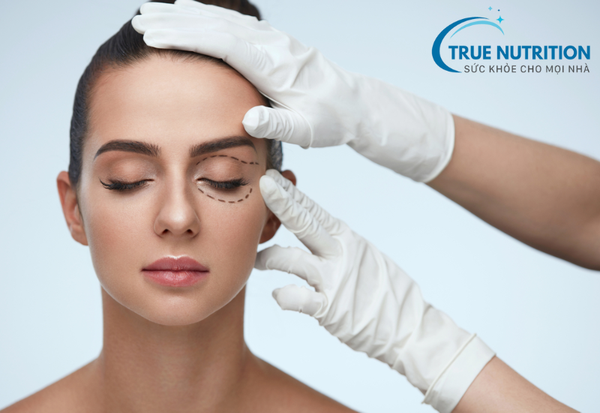 Cắt mí: Những điều bạn cần biết trước khi thực hiện