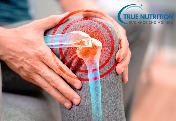 Vì sao bạn bị đau xương khớp? Lý do và phương pháp ngăn ngừa hiệu quả