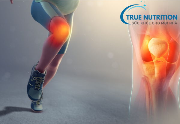 Vì sao bạn bị đau xương khớp? Lý do và phương pháp ngăn ngừa hiệu quả