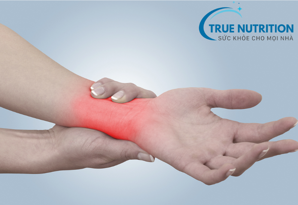 Đau nhức viêm khớp: Điều trị và phòng ngừa đúng cách