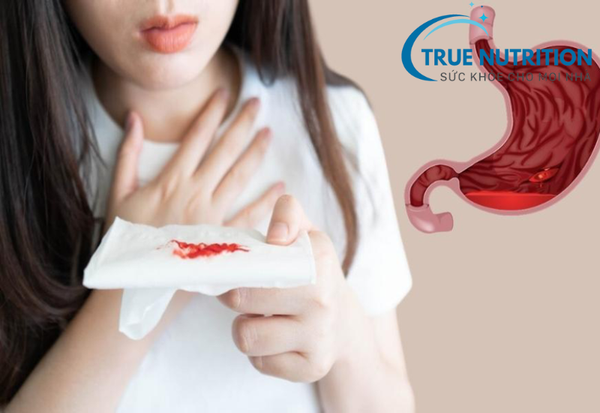 xuất huyết dạ dày có phải mổ không